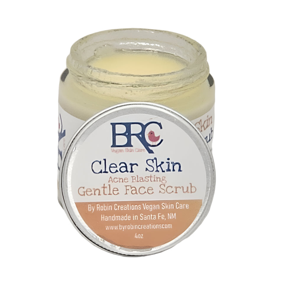 Clear Skin Deluxe Acne Healing Facial Bundle with Free Healing Cleansing Bar